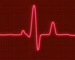 electrocardiogram 